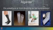 Arteriella bensår SSK